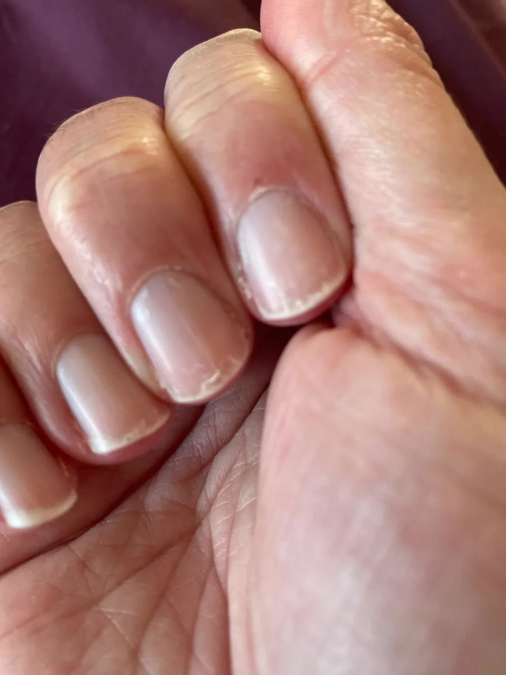 Nailberry Rescue Serum nagelserum 14 ml