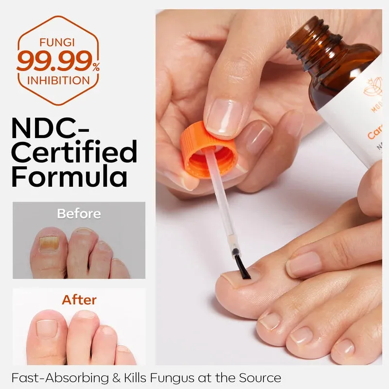 Modelones Nail Antifungal Treatment nagelolja